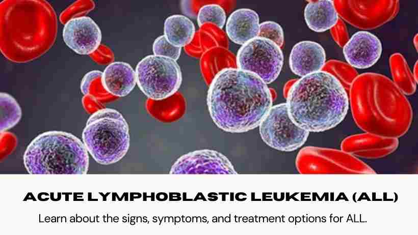 Acute Lymphoblastic Leukemia Awareness Ribbon
