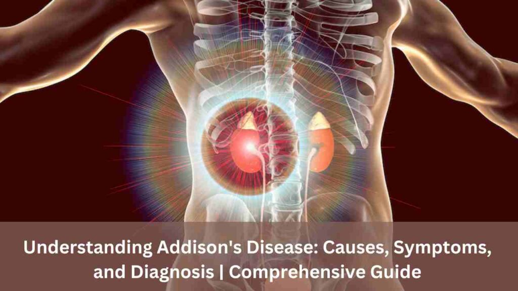 Understanding Addison's Disease: Causes, Symptoms, and Diagnosis | Comprehensive Guide